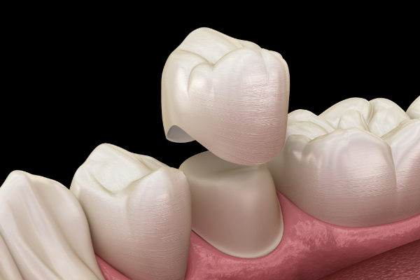 top rated dentist in Colchester
